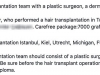 hair-transplant-implant-par-pret2
