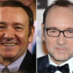 KEVIN-SPACEY-hair-transplant