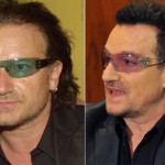Caru’ cu vedete – Transplantul de par al lui Bono de la U2