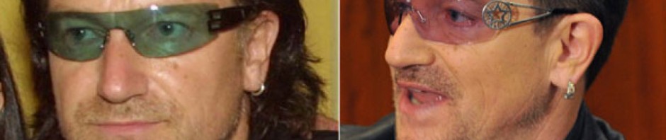 bono-u2-hair-transplant-implant-par