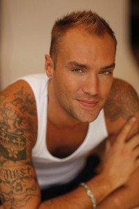 calum-best-before-hair inainte de transplantu de par