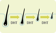 DHT Dihidrotestosteron