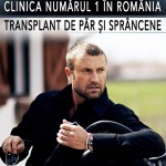 Catalin Botezatu isi face transplant de par? Designerul este noua imagine a clinicii Dr. Felix Hair Implant!