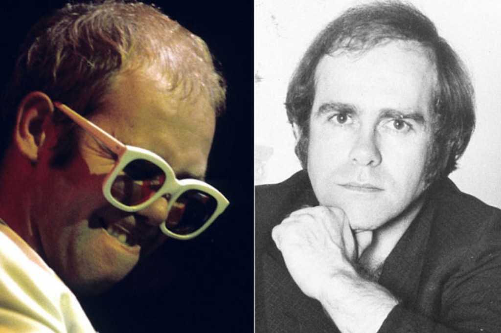 elton-john-hair-transplant-implant-par