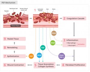 Factorii de crestere PRP