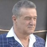 Gigi Becali isi face implant de par?