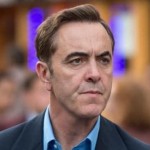 james-nesbitt-implant-par