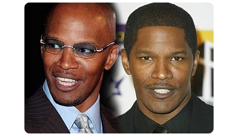 jamie-foxx-before-after-hair-implant