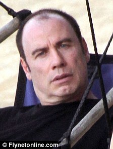 john-travolta-baldness