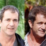 Caru’ cu vedete – Transplantul de par al lui Mel Gibson