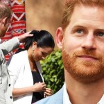 prince harry hair transplant de par