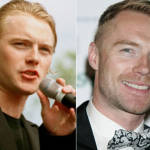 Ronan Keating Boyzone - Hair Transplant