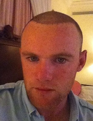 Rooney Rooney imediat dupa implantul de par