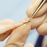 Transplant de par – Metode si intrumente de implantare – Penseta versus Implanter