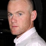 Rooney dupa al doilea implant - hair transplant