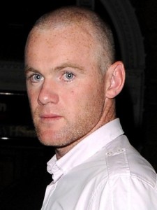 Rooney dupa al doilea implant - hair transplant